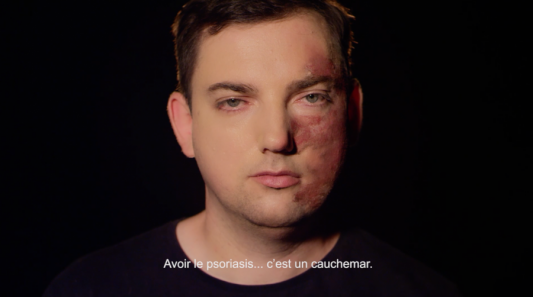 Psoriasis-Contact asbl